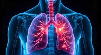 Perspektiven zu Lungenkrebs und seiner Bekämpfung